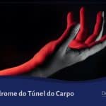 Síndrome do Túnel do Carpo
