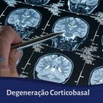 Degeneração Corticobasal