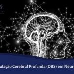 Estimulação Cerebral Profunda DBS