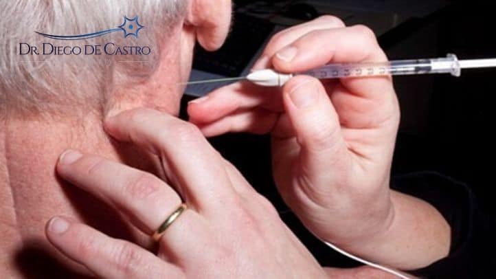 Aplicação de Toxina Botulínica para Distonia Cervical botox para distonia cervical