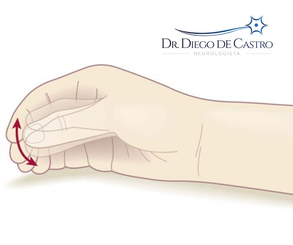 Tremor de Repouso Tremor no Parkinson