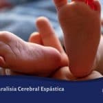 Paralisia Cerebral Espástica - Características, Tipos e Sintomas