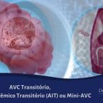 AVC Transitório