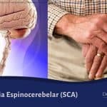 Ataxia Espinocerebelar (SCA)