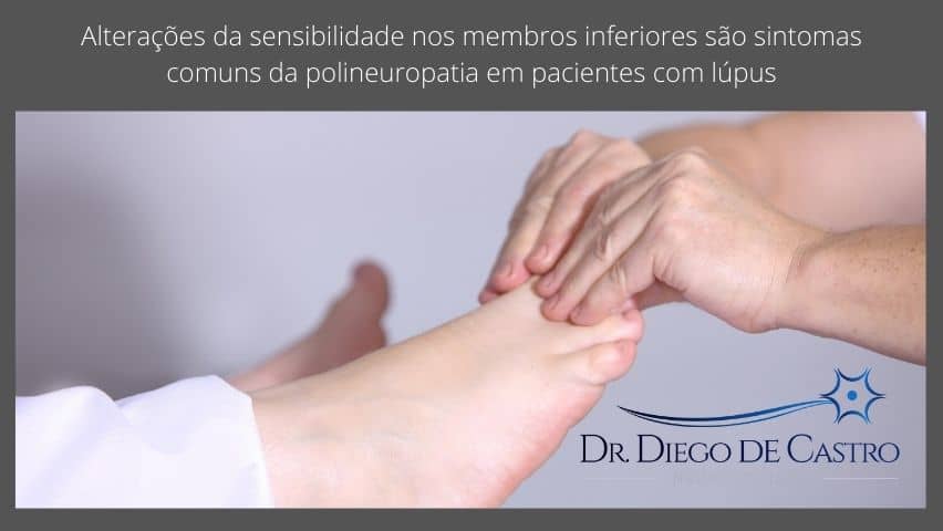 Neuropatia no lúpus Neuropatia no lúpus