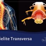 Mielite transversa