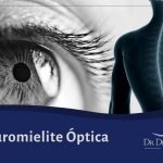 Neuromielite Óptica