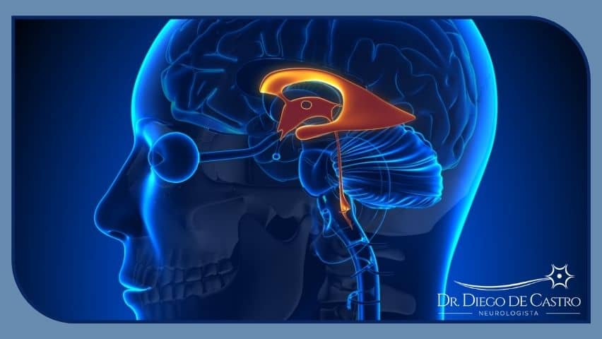 Representação dos ventrículos cerebrais