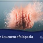 Tipos de Leucoencefalopatia
