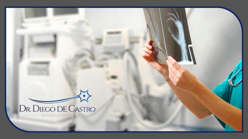 Raios-X e outros exames de imagem podem ajudar no diagnóstico da tendinite na mão Raios-X e outros exames de imagem podem ajudar no diagnóstico da tendinite na mão