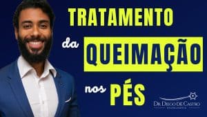 Tratamento da Queimação nos Pés