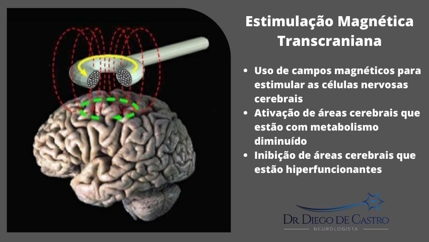 Estimulação Magnética Transcraniana