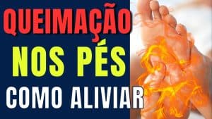 Acabar com a Queimação nos Pés
