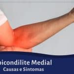 Epicondilite Medial - Causas e Sintomas