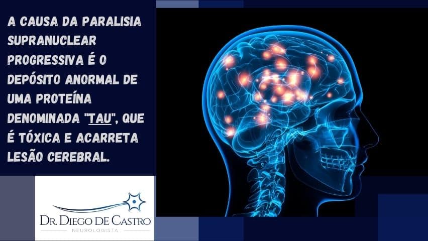 proteína tau