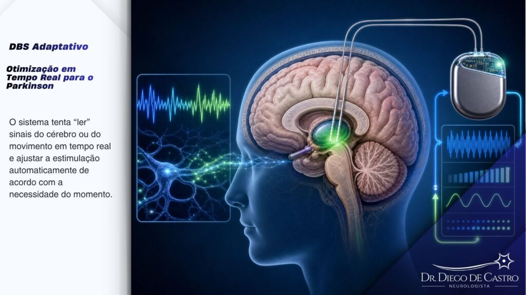 Diagrama detalhado de um cérebro humano com eletrodos de DBS implantados, mostrando a atividade cerebral sendo monitorada e a estimulação ajustada dinamicamente em tempo real, ilustrando a abordagem adaptativa para o tratamento do Parkinson.