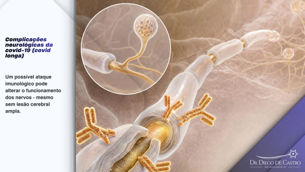 Como autoanticorpos podem afetar os nervos na covid longa — Dr. Diego de Castro Ilustração didática de autoanticorpos afetando uma fibra nervosa periférica na covid longa