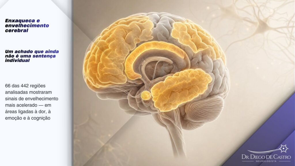 Regiões cerebrais associadas à enxaqueca crônica | Dr. Diego de Castro Ilustração anatômica do cérebro com regiões pré-frontal, frontal, cingulada, parietal, temporal e amígdala destacadas em dourado.