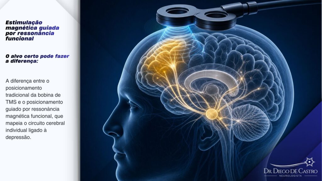 Como a ressonância funcional orienta o alvo da TMS — Dr. Diego de Castro Ilustração técnica do cérebro com o córtex pré-frontal dorsolateral destacado e conectado a circuitos cerebrais profundos durante a estimulação magnética transcraniana guiada por conectividade.