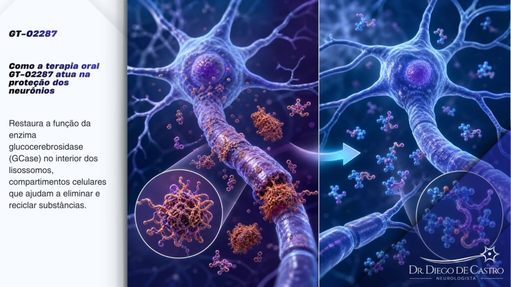 Visão microscópica de neurônios cerebrais, com proteínas alfa-sinucleína se aglomerando em um lado e o medicamento GT-02287 impedindo ativamente essa agregação no outro, demonstrando o mecanismo de ação da terapia oral para Parkinson.