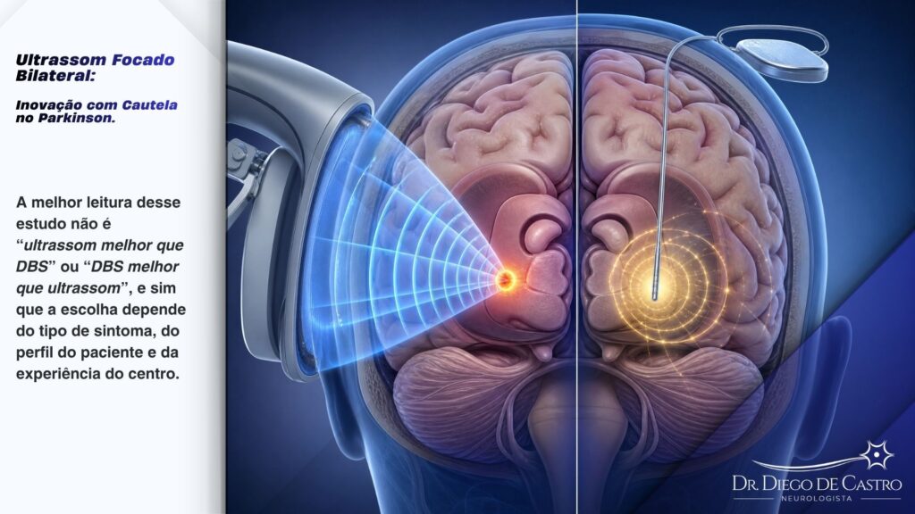 Ultrassom Focado Bilateral: Diagrama comparativo do cérebro humano: o lado esquerdo ilustra as ondas de ultrassom criando uma lesão terapêutica precisa, enquanto o lado direito mostra um eletrodo de DBS emitindo pulsos elétricos de modulação.