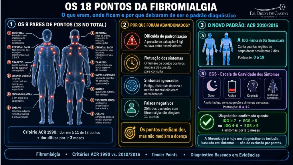 os 18 pontos de pressão da fibromialgia Infográfico sobre os 18 pontos de pressão da fibromialgia e a evolução dos critérios diagnósticos. À esquerda, silhuetas humanas frontal e dorsal com os 18 pontos sensíveis marcados em vermelho nas suas localizações anatômicas exatas — occipital, cervical baixa, trapézio, supra-espinhoso, segunda costela, epicôndilo lateral, glúteo, trocânter maior e joelho — conforme os critérios ACR 1990, que exigiam dor em pelo menos 11 desses pontos. Ao centro, quatro razões pelas quais os pontos foram abandonados como padrão diagnóstico: dificuldade de padronização da palpação, flutuação dos sintomas entre consultas, omissão de fadiga e distúrbios do sono, e 25% de falsos negativos. À direita, o novo padrão ACR 2010/2016, baseado no Índice de Dor Generalizada (IDG, 0 a 19) e na Escala de Gravidade dos Sintomas (EGS, 0 a 12), com os critérios combinados para confirmação diagnóstica e a afirmação de que a fibromialgia é hoje um diagnóstico de inclusão baseado em sintomas.