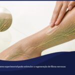 Aplicação de creme tópico na perna de um paciente, com ilustração de fibras nervosas se regenerando sob a pele, representando o estudo sobre pirenzepina e neuropatia diabética.