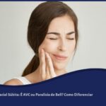 Paralisia Facial Súbita