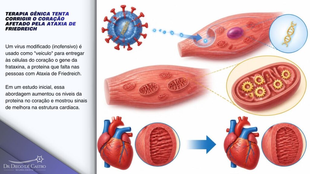 Diagrama em três etapas mostrando como a terapia gênica entrega o gene da frataxina às células cardíacas e ajuda a normalizar a espessura do músculo do coração.