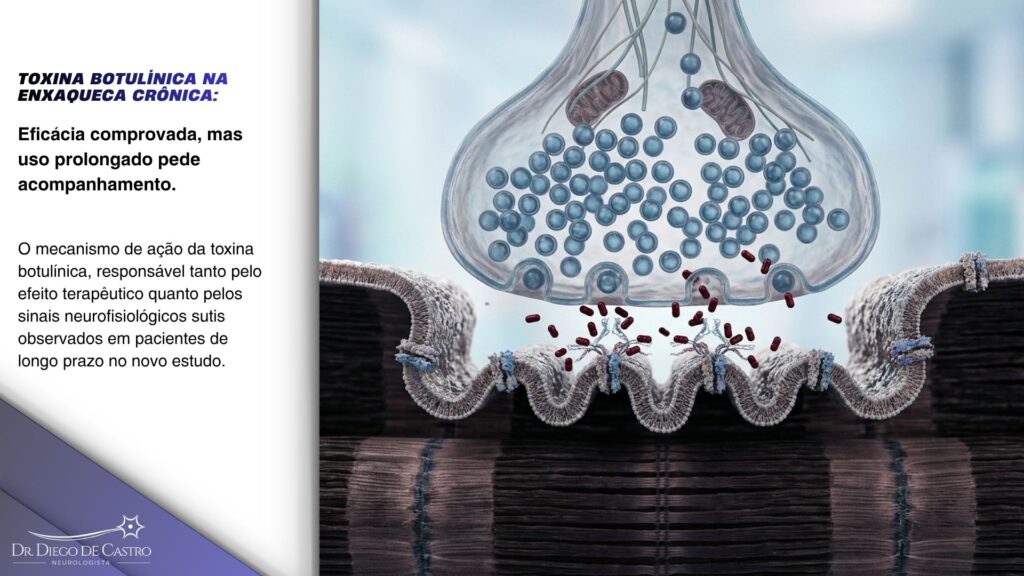 Ilustração esquemática da junção neuromuscular mostrando o bloqueio da liberação de acetilcolina pela toxina botulínica.