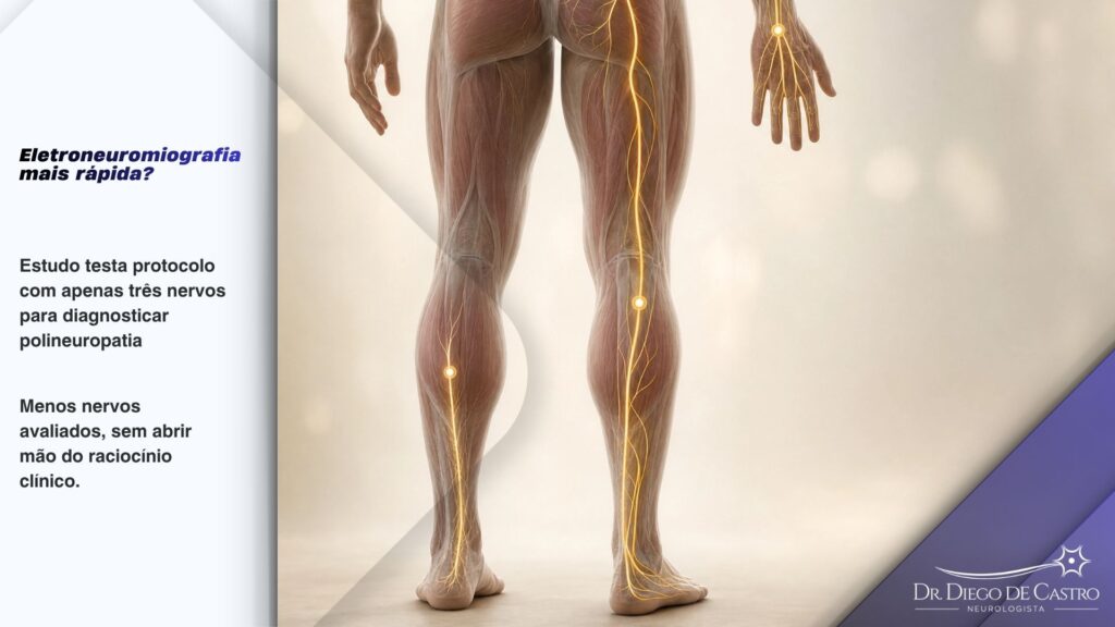 Três nervos avaliados no protocolo de ENMG para polineuropatia — Dr. Diego de Castro Ilustração anatômica dos nervos sural, tibial e ulnar destacados nos membros inferiores e superiores durante a investigação de polineuropatia.