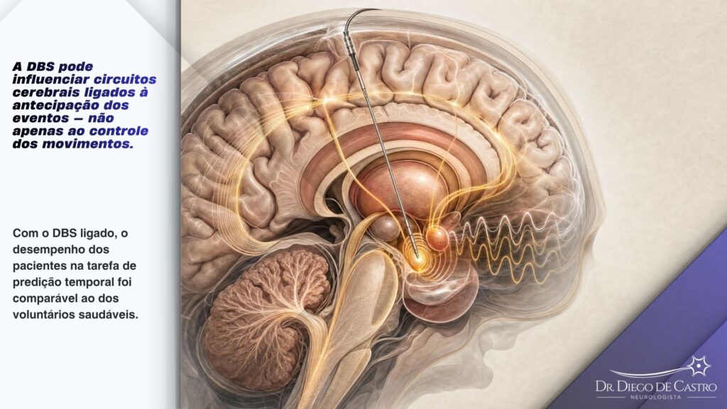Como a estimulação cerebral profunda modula os circuitos do Parkinson | Dr. Diego de Castro Ilustração anatômica do cérebro mostrando o eletrodo de estimulação cerebral profunda no núcleo subtalâmico e a modulação dos circuitos dos gânglios da base.