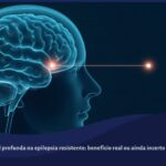 Ilustração de um cérebro humano translúcido com um eletrodo luminoso inserido profundamente, representando a estimulação cerebral profunda para epilepsia.