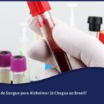 Exame de Sangue para Alzheimer