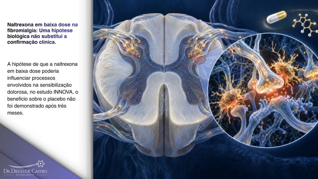 Hipótese neuroimune da naltrexona em baixa dose na fibromialgia — Dr. Diego de Castro Ilustração técnica da região posterior da medula espinal com terminações nervosas, sinapses e células neuroimunes, representando a hipótese de modulação da sensibilização da dor pela naltrexona em baixa dose.