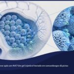 Ilustração 3D de um cérebro semi-transparente com uma rede de microesferas de hidrogel brilhando em azul na região de uma lesão, representando um andaime injetável em estudo para reparo cerebral após AVC.