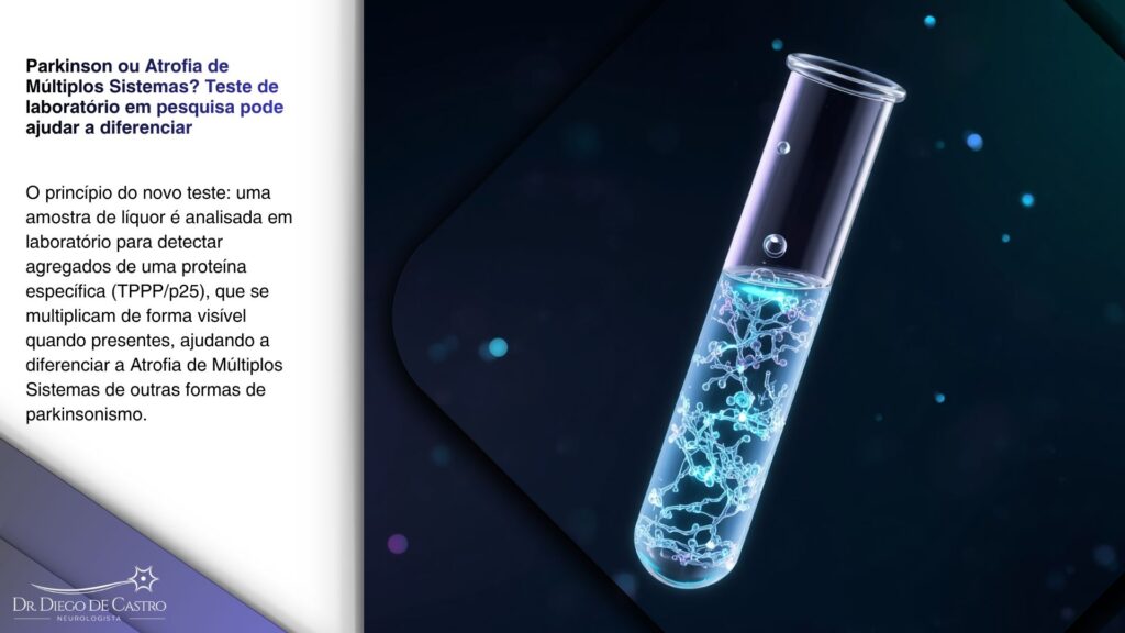 Ilustração 3D de um tubo de ensaio de vidro com uma gota caindo e fibrilas de proteína se multiplicando em cadeia, representando o mecanismo de um teste de líquor para Atrofia de Múltiplos Sistemas. Ilustração 3D de um tubo de ensaio de vidro com uma gota caindo e fibrilas de proteína se multiplicando em cadeia, representando o mecanismo de um teste de líquor para Atrofia de Múltiplos Sistemas.